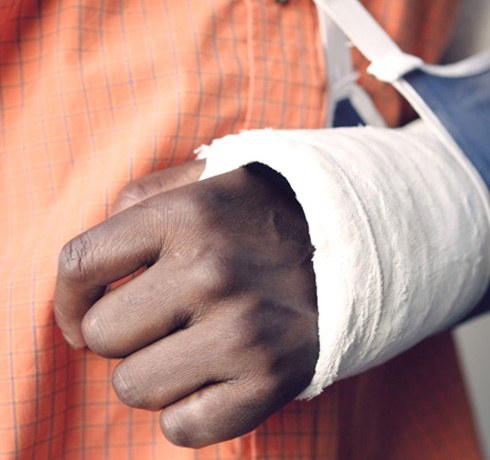 Hand Surgery